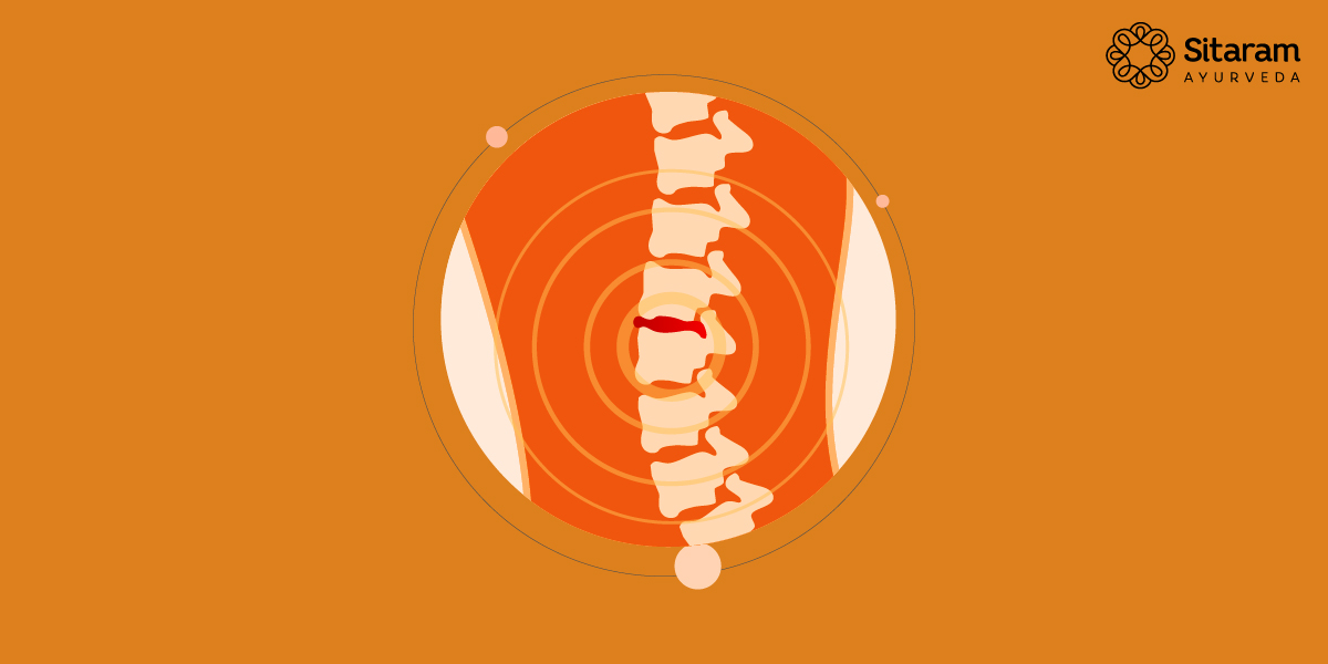 Healing Lumbar Disc Bulge Naturally